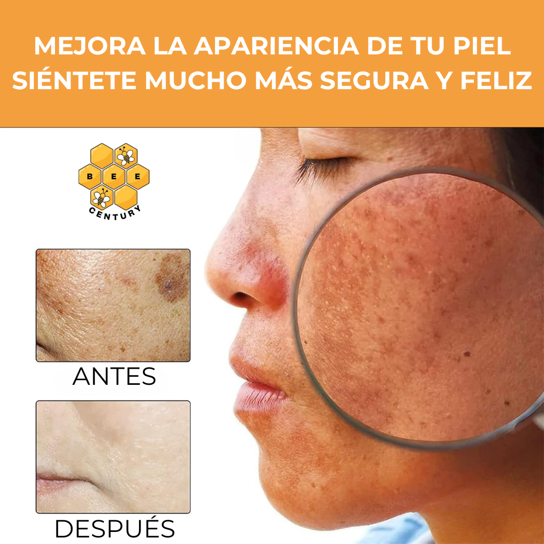 MELANINA FACIAL™ - QUITA MANCHAS